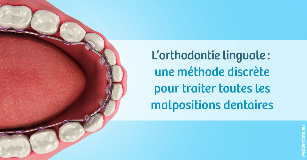 https://selarl-terre-de-sante.chirurgiens-dentistes.fr/L'orthodontie linguale 1