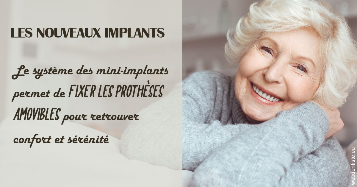 https://selarl-terre-de-sante.chirurgiens-dentistes.fr/Les nouveaux implants 1