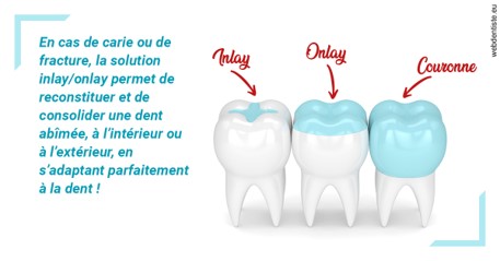 https://selarl-terre-de-sante.chirurgiens-dentistes.fr/L'INLAY ou l'ONLAY