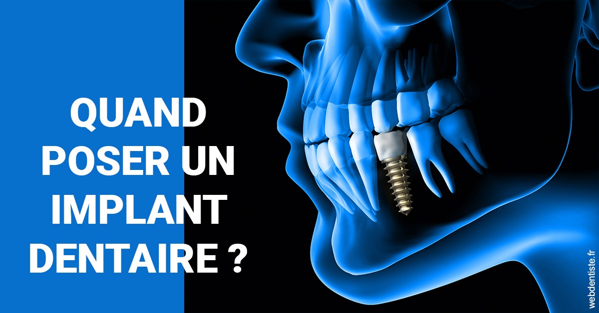https://selarl-terre-de-sante.chirurgiens-dentistes.fr/Les implants 1