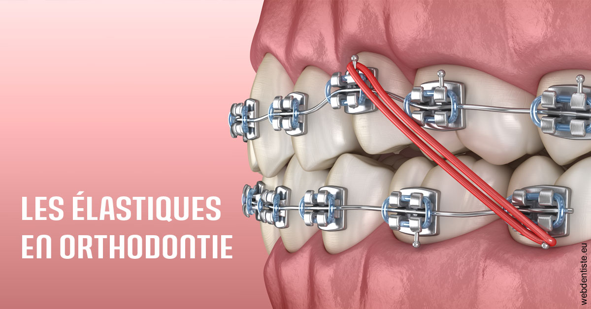 https://selarl-terre-de-sante.chirurgiens-dentistes.fr/Elastiques orthodontie 2
